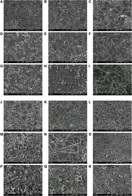 Preparation and optimization of poly (lactic-co-glycolic acid) rod-shaped particles in nano size range for paclitaxel delivery